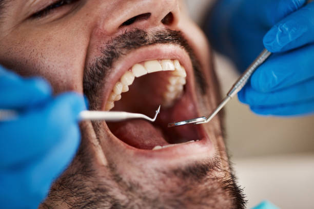 Best Dental Fillings (Composite and Amalgam)  in Lawrencevle, IL